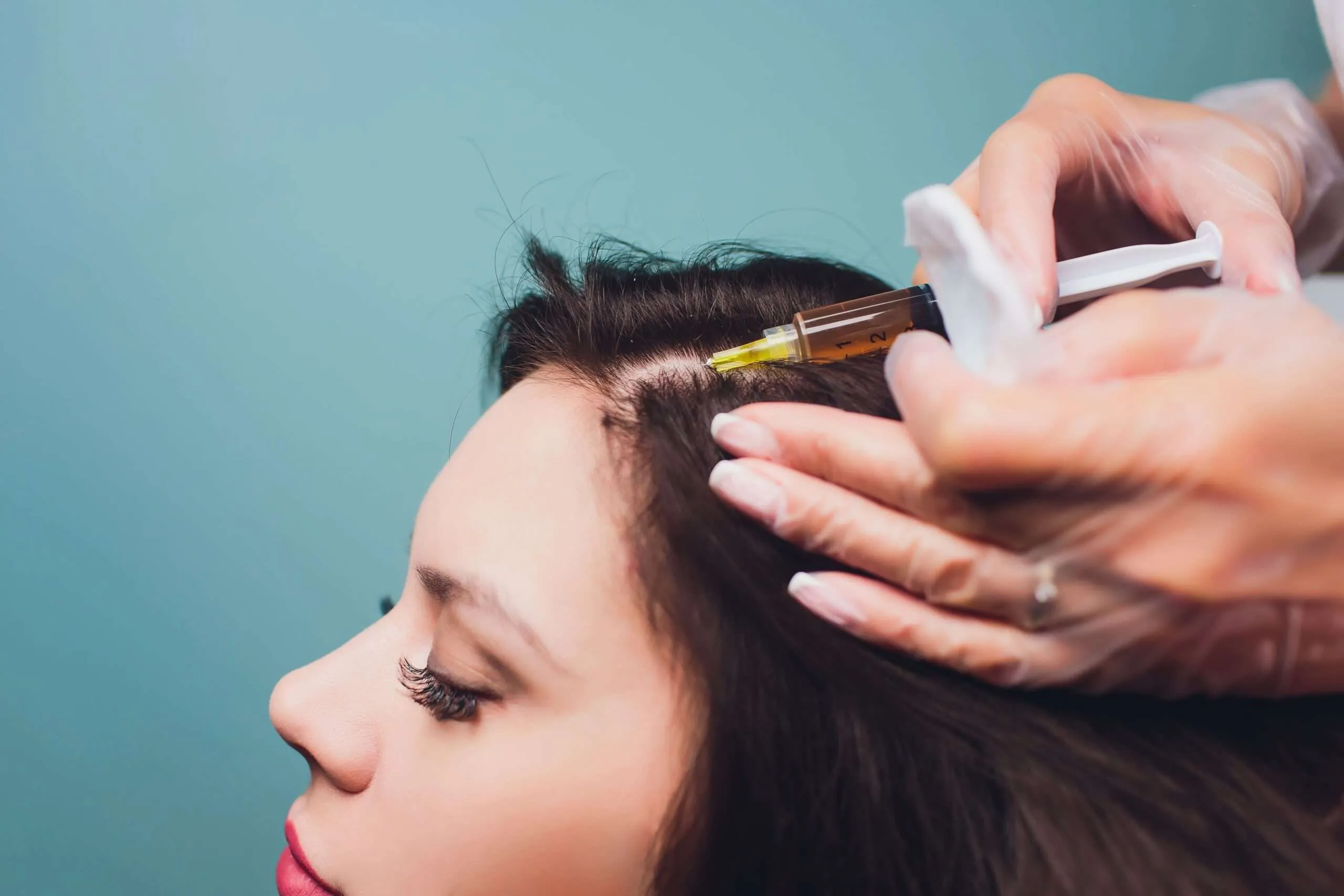 Prp Treatment