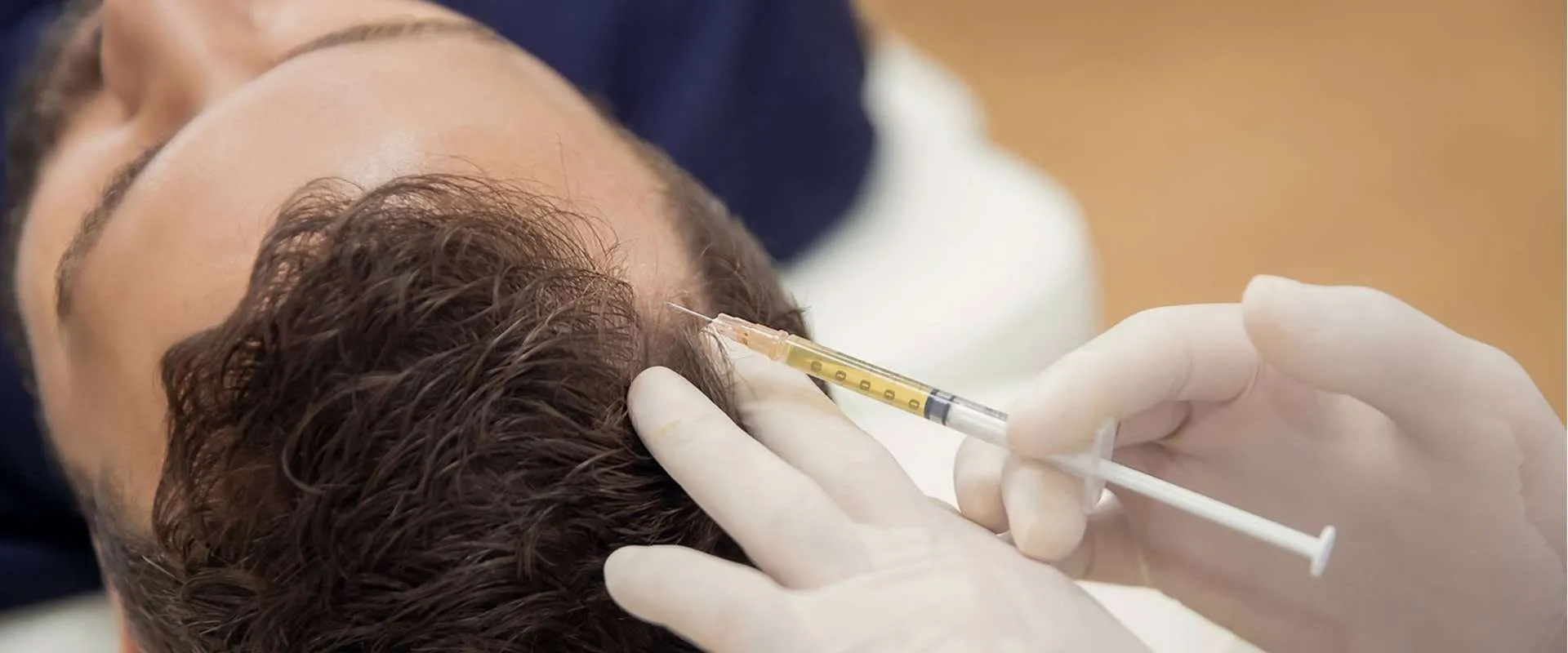 Prp Treatment